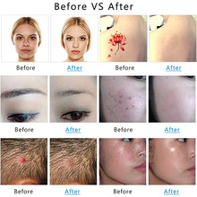 Load image into Gallery viewer, TBD0603542301_B9.jpg@802c3cfb4ec38a3ccdfe65df6f557433