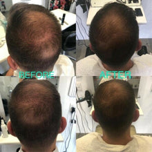 Load image into Gallery viewer, NU SKIN Ageloc Nutriol Scalp & Hair Treatment System Maverick Sales 1