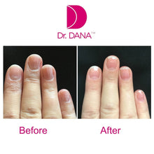 Load image into Gallery viewer, DR DANA Nail Renewal System
